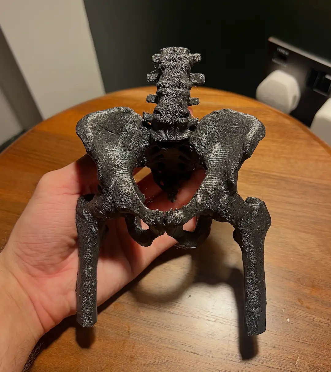 A 3D printed pelvis made using a Prusa 3D printer. The pelvis was exported from Invisaid and printed using PETG black filament.