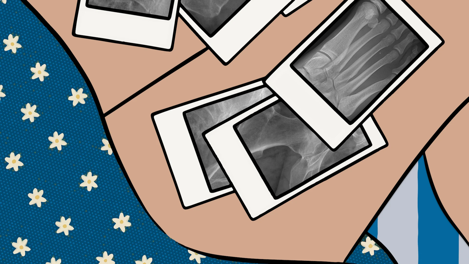 An illustration of a woman sitting with polaroid images of X-ray radiographs on her legs.